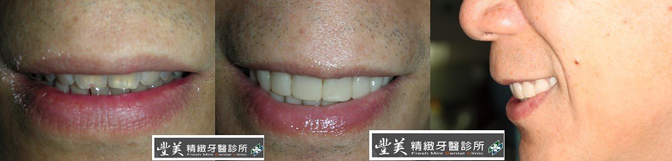 修正保健品是贴牌吗