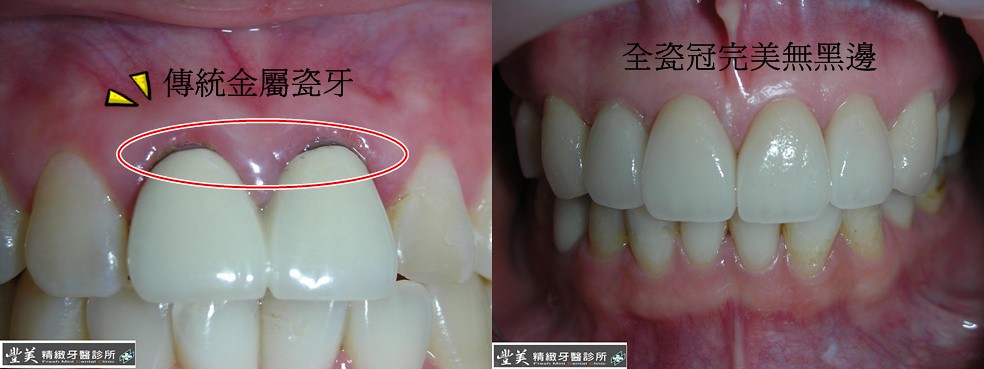 补肾汤的做法大全