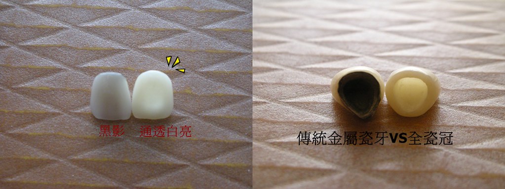改善壮阳补肾药