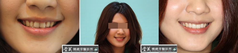 保健品详细介绍