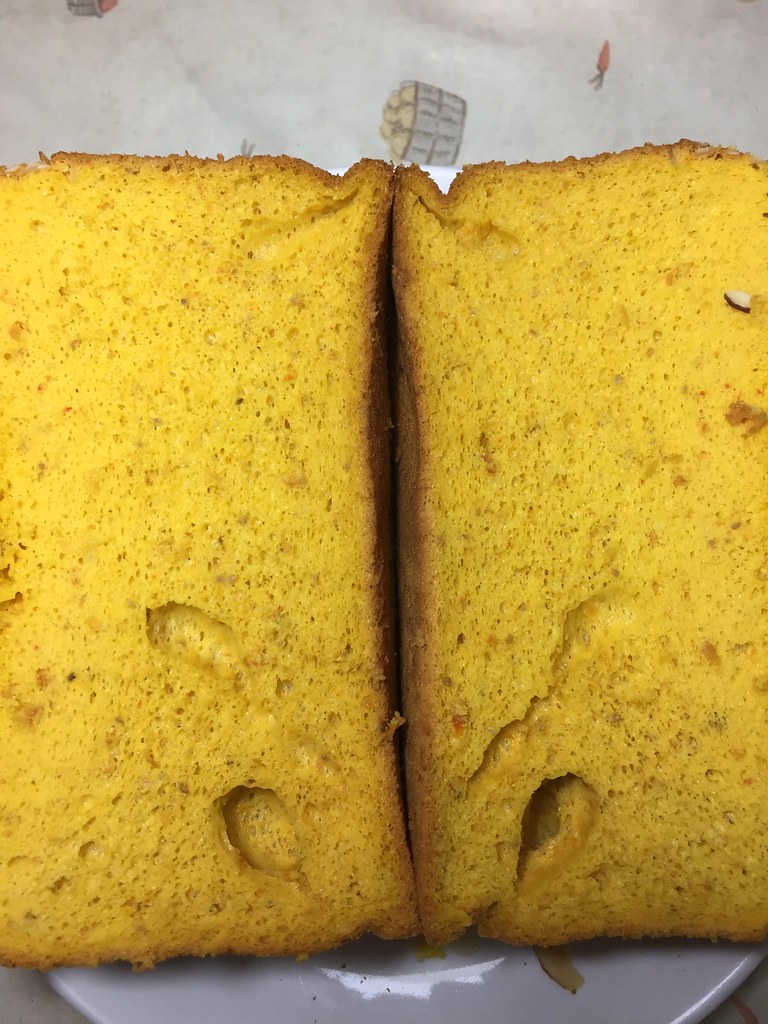 肝血管瘤会增大吗